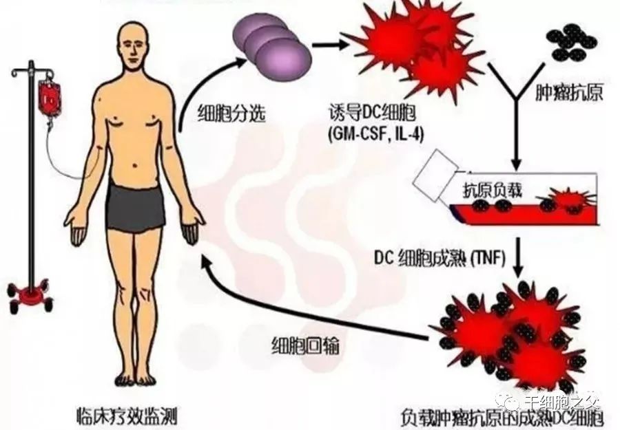 挑戰癌王！諾獎得主斯坦曼“以身試藥”，樹突狀細胞療法将他(tā)生存期延長(cháng)4年半(圖4)