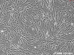 纖維細胞(圖1)